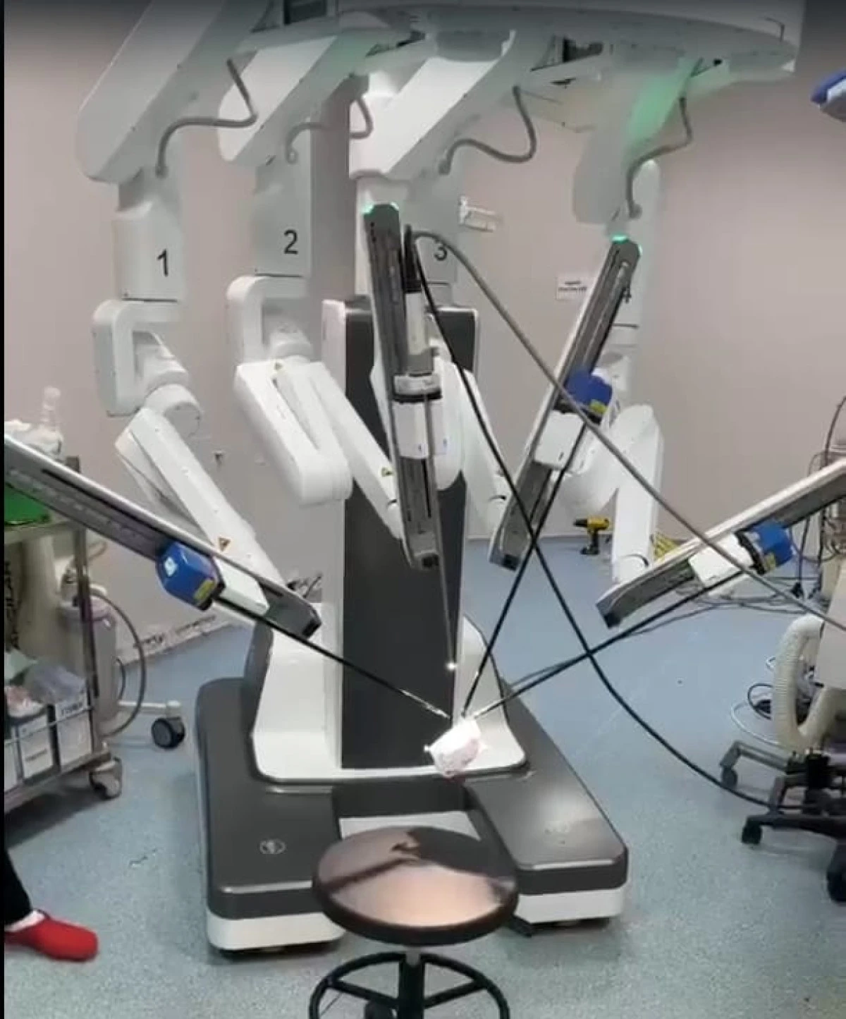 BA&Uuml;N Hastanesi Robotik Cerrahi Teknolojisiyle G&uuml;&ccedil;leniyor