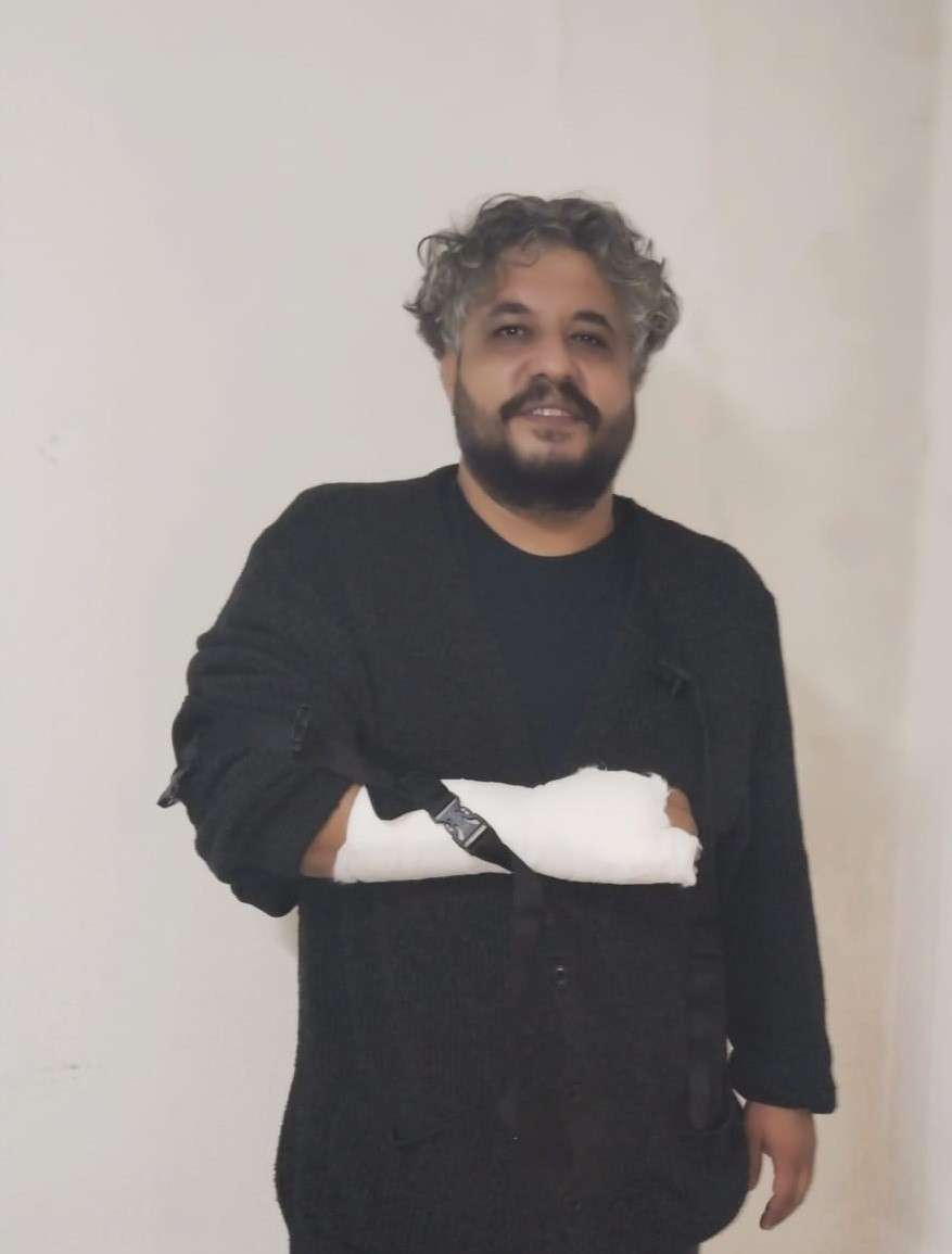 ''HOŞ GELDİN AMERİKA'' DA TALİHSİZ KAZA